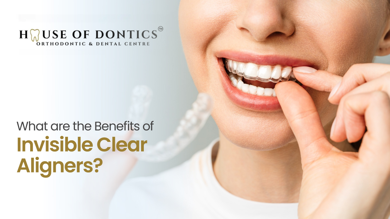 Invisible Clear Aligners Invisible Clear Aligners