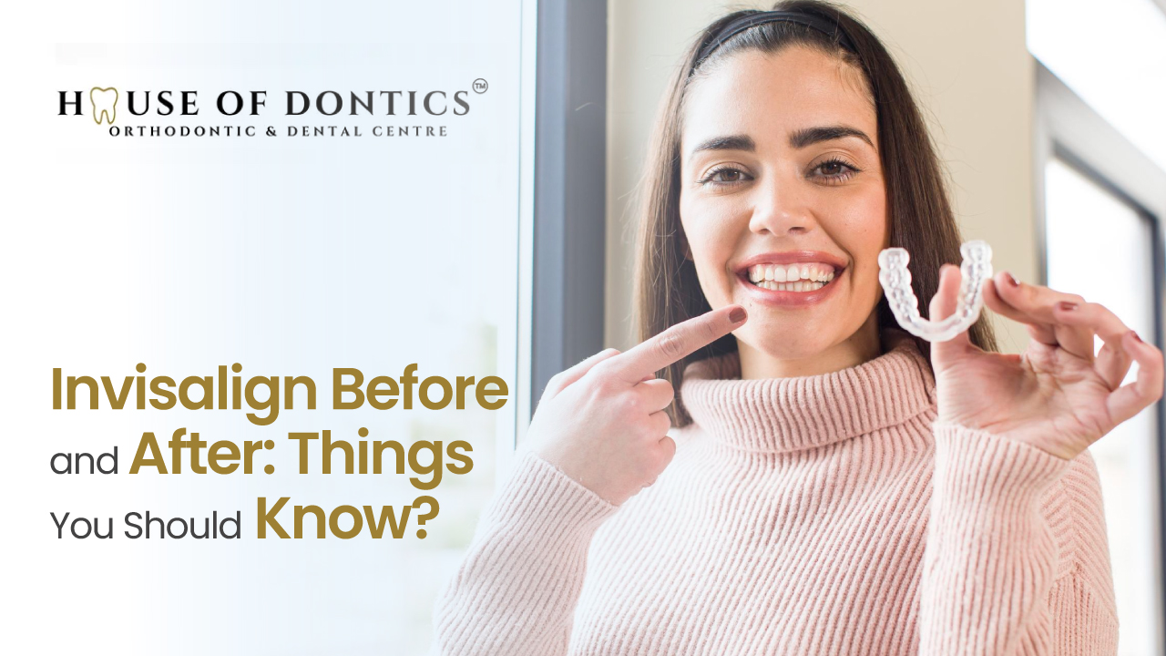 Invisalign Treatment in Ahmedabad
