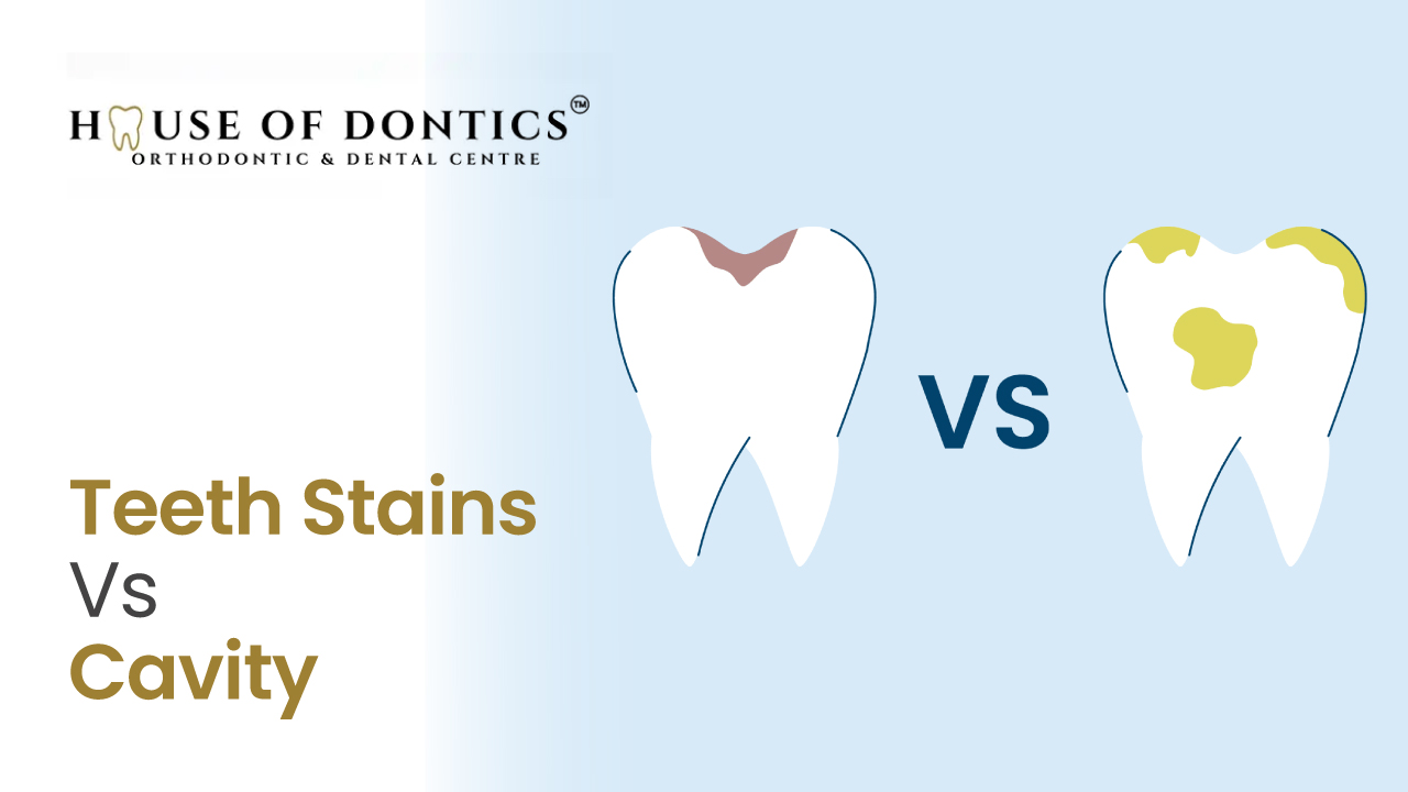 teeth stains vs teeth activies teeth stains vs teeth activies
