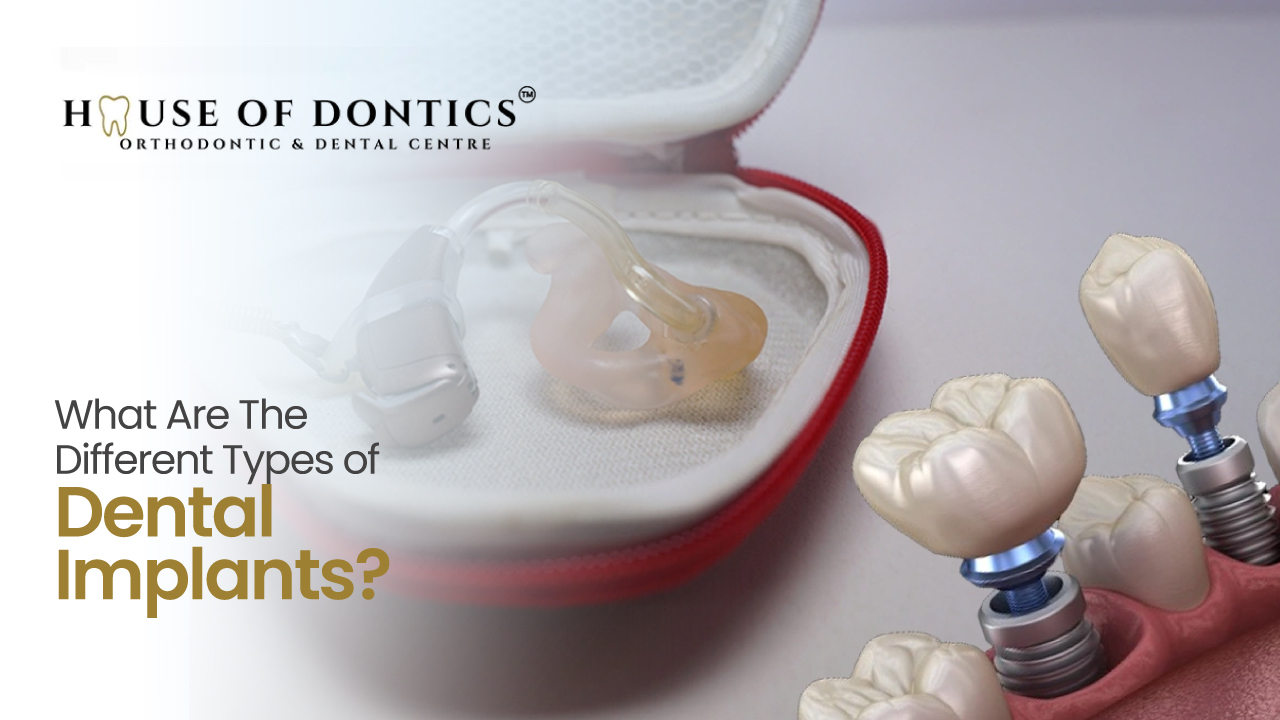Types of Dental Implants Types of Dental Implants