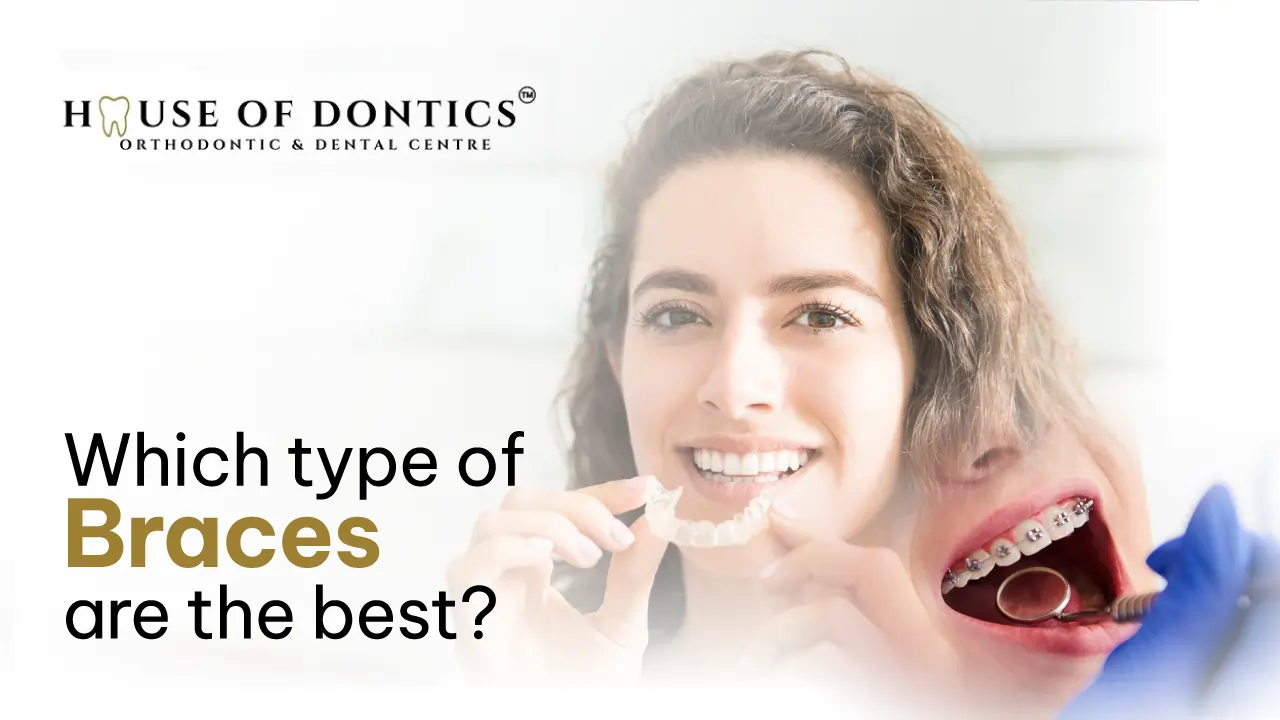 which type of braces are the best