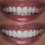 best-cosmetic-contouring-in-ahmedabad