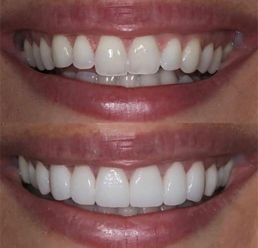 best-cosmetic-contouring-in-ahmedabad