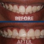 best-cosmetic-contouring-treatment-in-ahmedabad