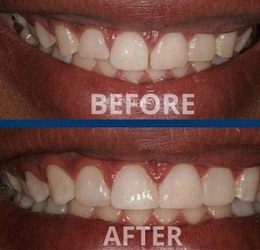 best-cosmetic-contouring-treatment-in-ahmedabad