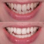 cosmetic-contouring-in-ahmedabad