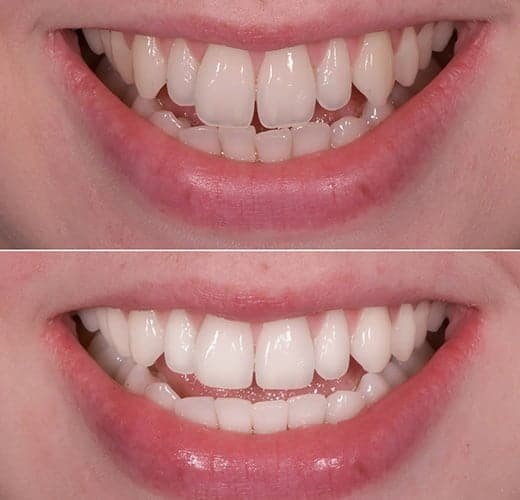 cosmetic-contouring-in-ahmedabad