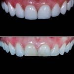 cosmetic-contouring-in-gujarat