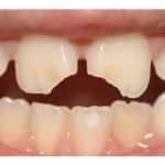 cosmetic-contouring-treatment-in-ahmedabad