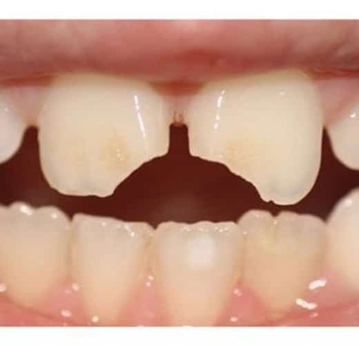 cosmetic-contouring-treatment-in-ahmedabad