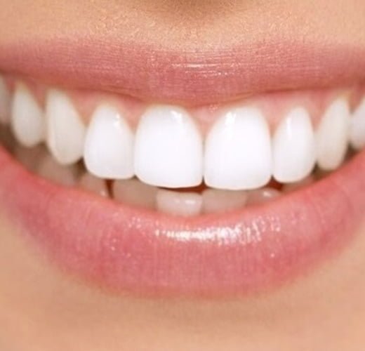 smile-makeover-in-ahmedabad