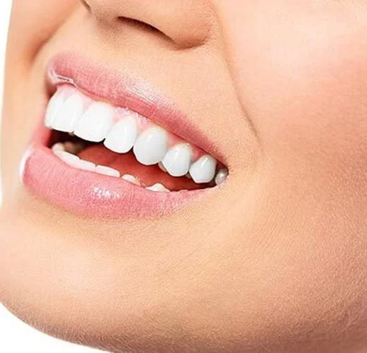 Teeth Cleaning and polishing in ahmedabad Teeth Cleaning and polishing in ahmedabad