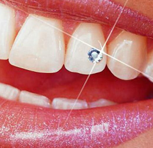 tooth-crystal-treatment-in-ahmedabad