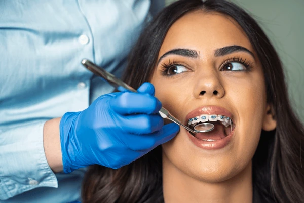 Dental braces treatment overview