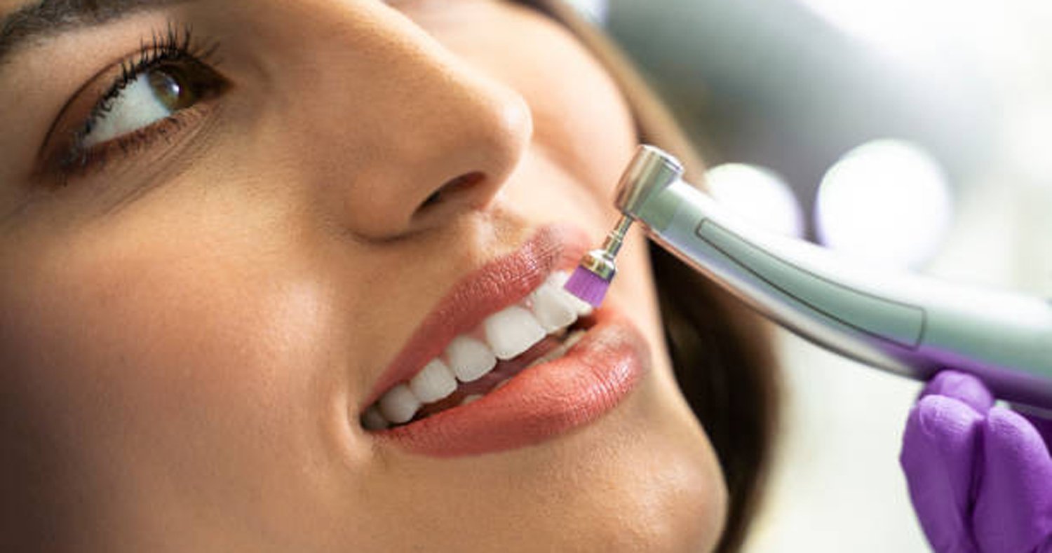 Teeth Cleaning & Polishing